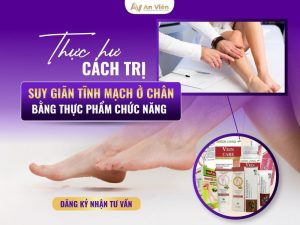 cách trị suy giãn tĩnh mạch ở chân