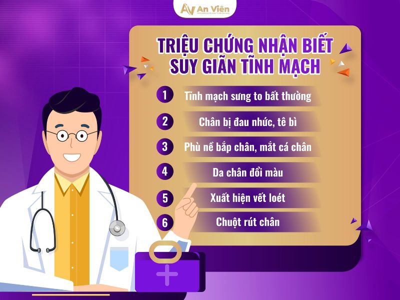 cách trị suy giãn tĩnh mạch ở chân
