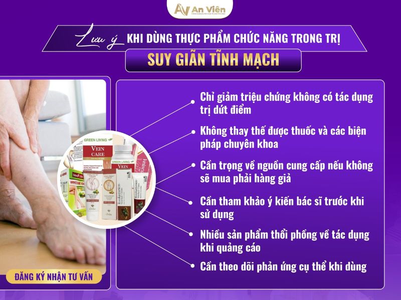 cách trị suy giãn tĩnh mạch ở chân