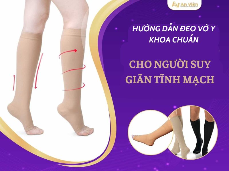 Điều trị bằng vớ y khoa khi chân bị giãn tĩnh mạch nhẹ được không? 15 chân bị giãn tĩnh mạch nhẹ