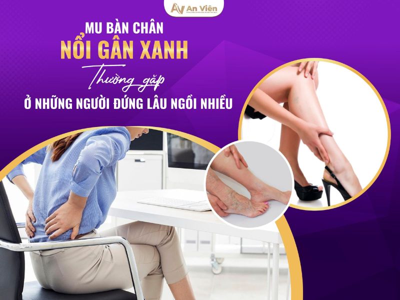 Điều trị bằng vớ y khoa khi chân bị giãn tĩnh mạch nhẹ được không? 17 chân bị giãn tĩnh mạch nhẹ