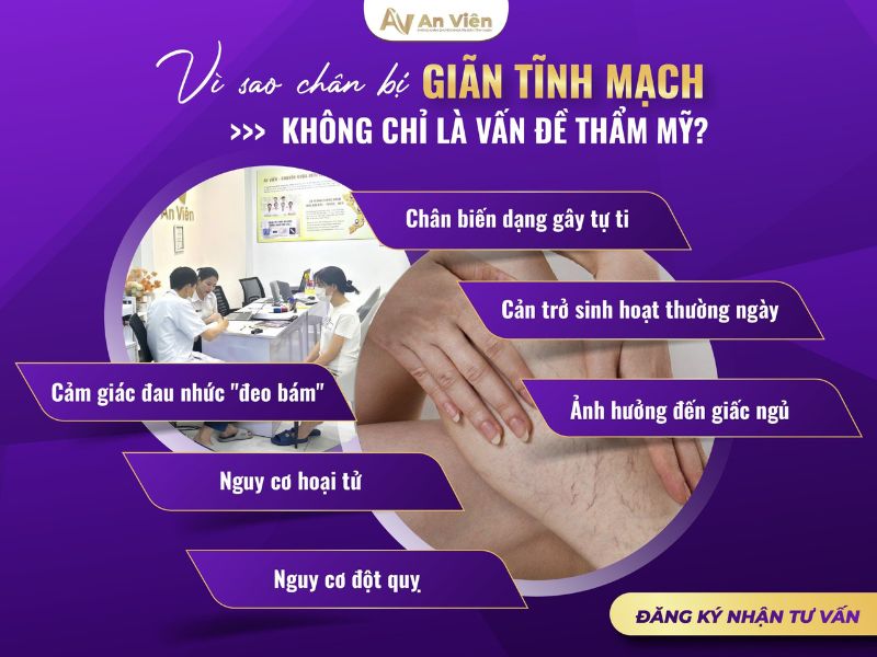 chân bị nổi mạch máu đỏ
