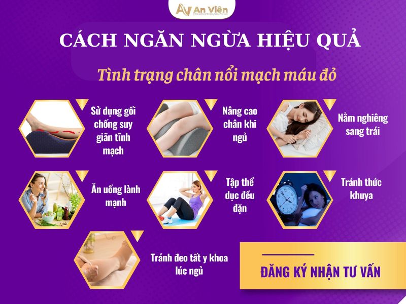 chân bị nổi mạch máu đỏ