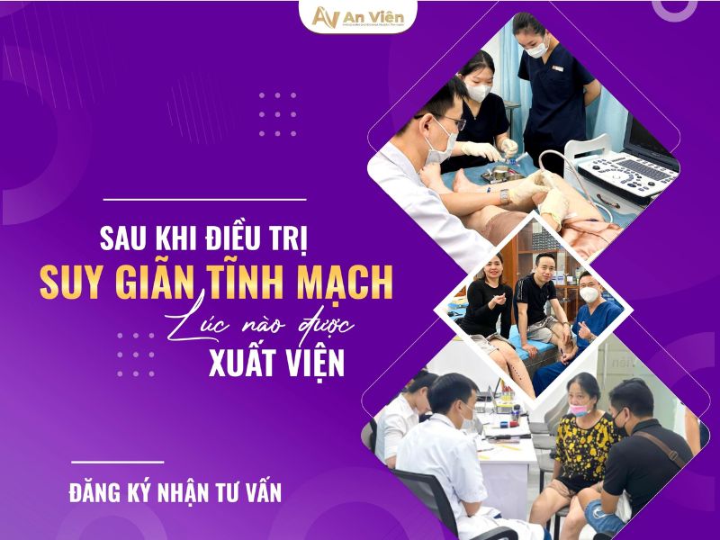 chân bị suy giãn tĩnh mạch