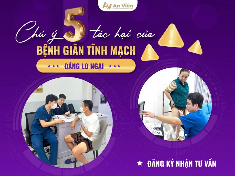 dấu hiệu bị giãn tĩnh mạch chân