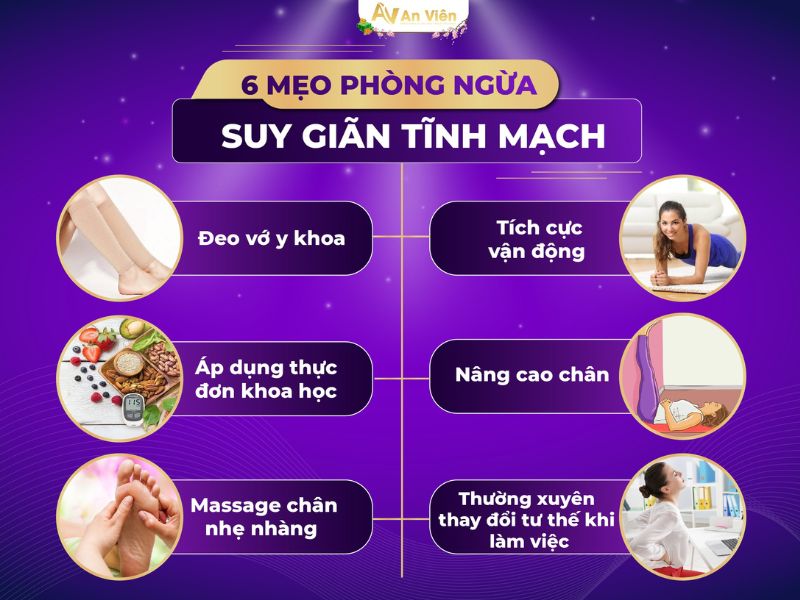 Dấu hiệu chân bị giãn tĩnh mạch do đứng lâu ngồi nhiều 16 dấu hiệu chân bị giãn tĩnh mạch