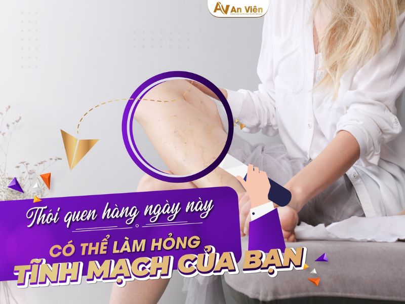 Dấu hiệu chân bị giãn tĩnh mạch do đứng lâu ngồi nhiều 10 dấu hiệu chân bị giãn tĩnh mạch