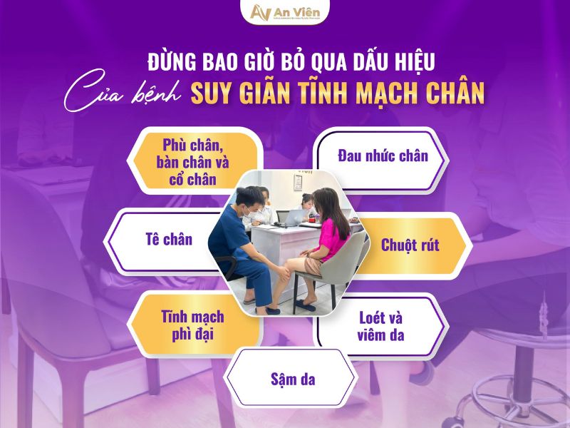 Dấu hiệu chân bị giãn tĩnh mạch do đứng lâu ngồi nhiều 14 dấu hiệu chân bị giãn tĩnh mạch