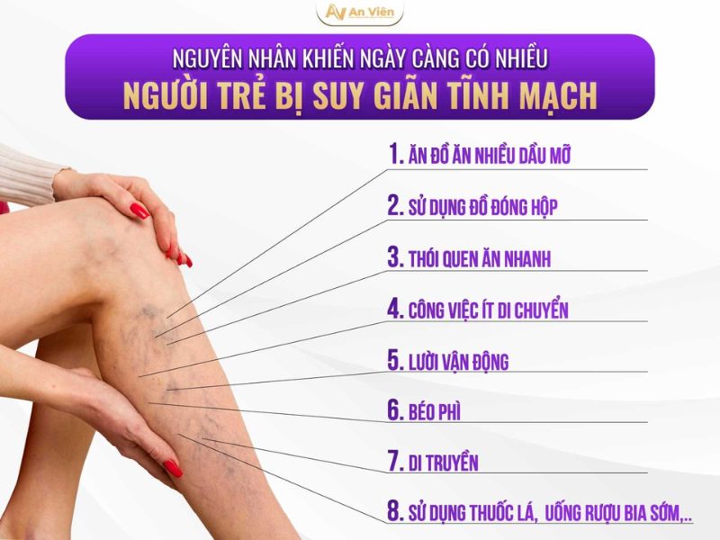 Nguyên nhân gây giãn tĩnh mạch ở người trẻ là do đâu? 13 nguyên nhân gây giãn tĩnh mạch