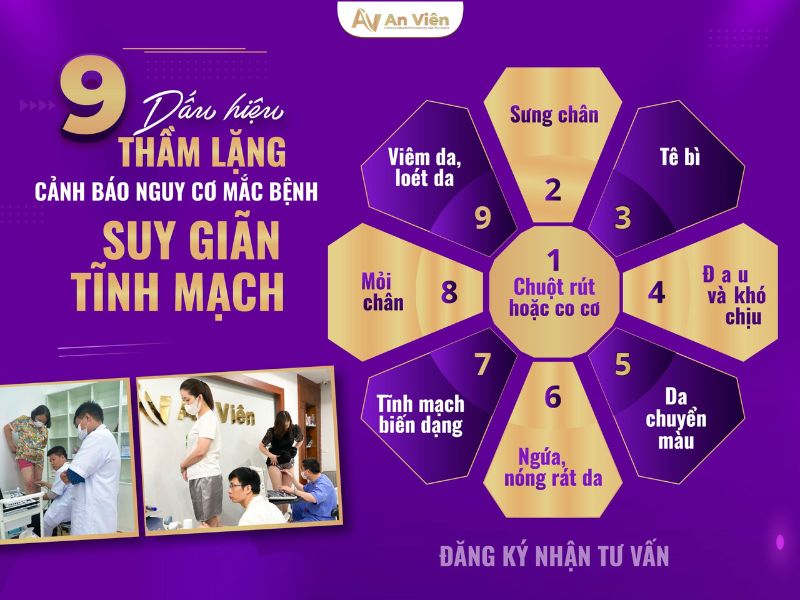 Nguyên nhân gây giãn tĩnh mạch ở người trẻ là do đâu? 11 nguyên nhân gây giãn tĩnh mạch