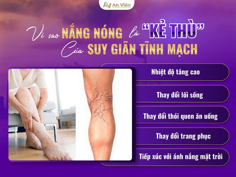 Thuộc 10 cách điều trị giãn tĩnh mạch chi dưới trong mùa hè 9 cách điều trị giãn tĩnh mạch chi dưới