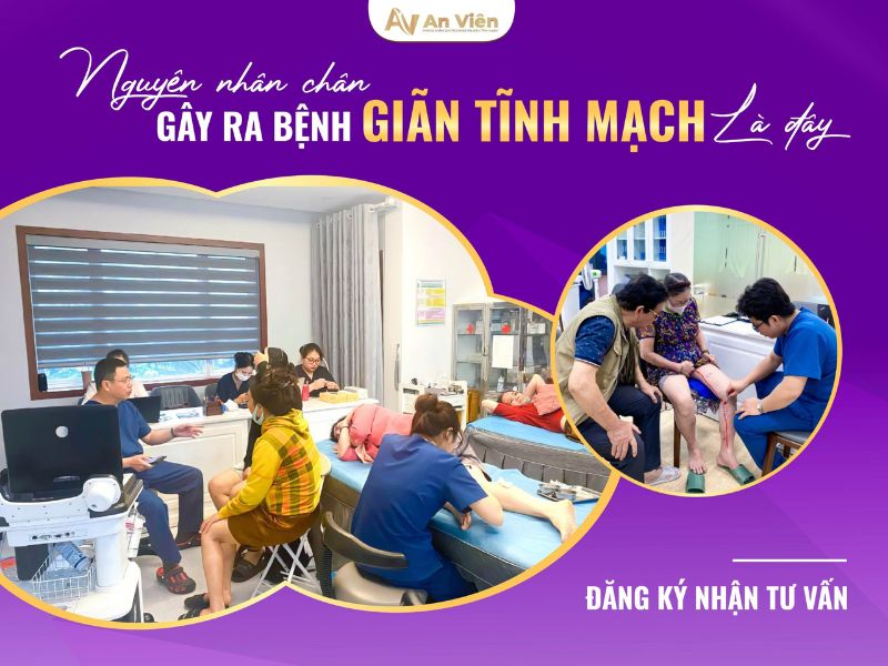 Thuộc 10 cách điều trị giãn tĩnh mạch chi dưới trong mùa hè 10 cách điều trị giãn tĩnh mạch chi dưới