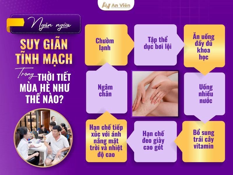 Thuộc 10 cách điều trị giãn tĩnh mạch chi dưới trong mùa hè 12 cách điều trị giãn tĩnh mạch chi dưới