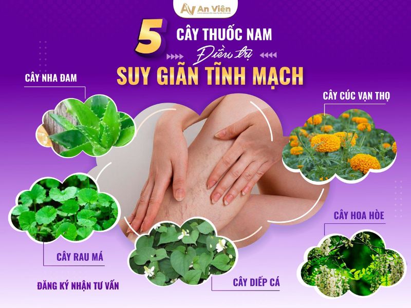 Thuộc 10 cách điều trị giãn tĩnh mạch chi dưới trong mùa hè 13 cách điều trị giãn tĩnh mạch chi dưới
