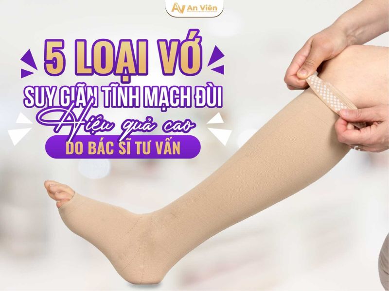 Thuộc 10 cách điều trị giãn tĩnh mạch chi dưới trong mùa hè 14 cách điều trị giãn tĩnh mạch chi dưới