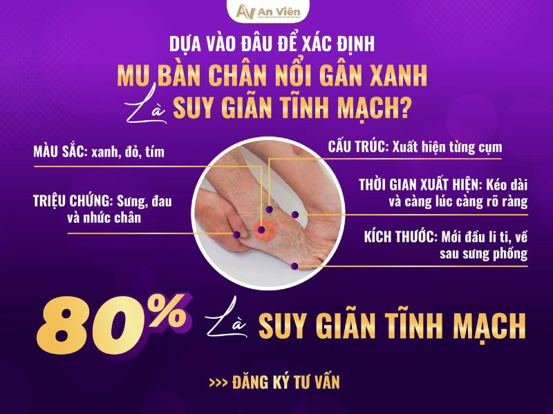 6 cách trị nổi gân tay chân hữu hiệu từ nguyên liệu tự nhiên 12 cách trị nổi gân tay chân