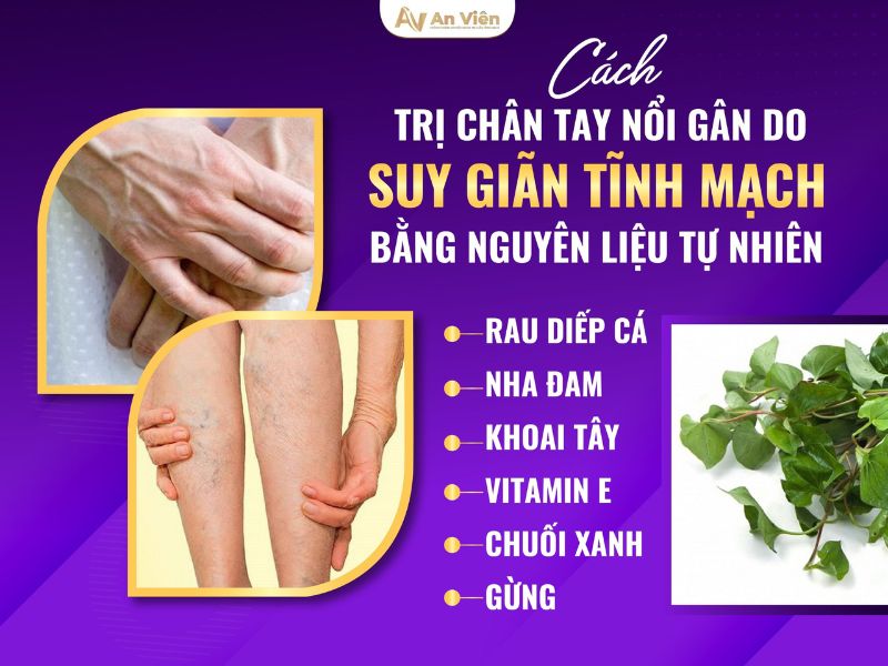 6 cách trị nổi gân tay chân hữu hiệu từ nguyên liệu tự nhiên 14 cách trị nổi gân tay chân