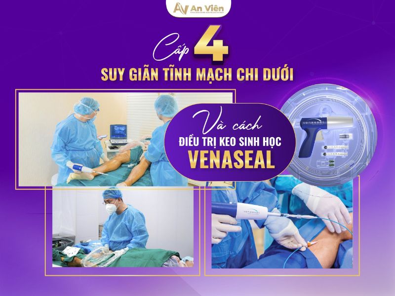 6 cách trị nổi gân tay chân hữu hiệu từ nguyên liệu tự nhiên 18 cách trị nổi gân tay chân