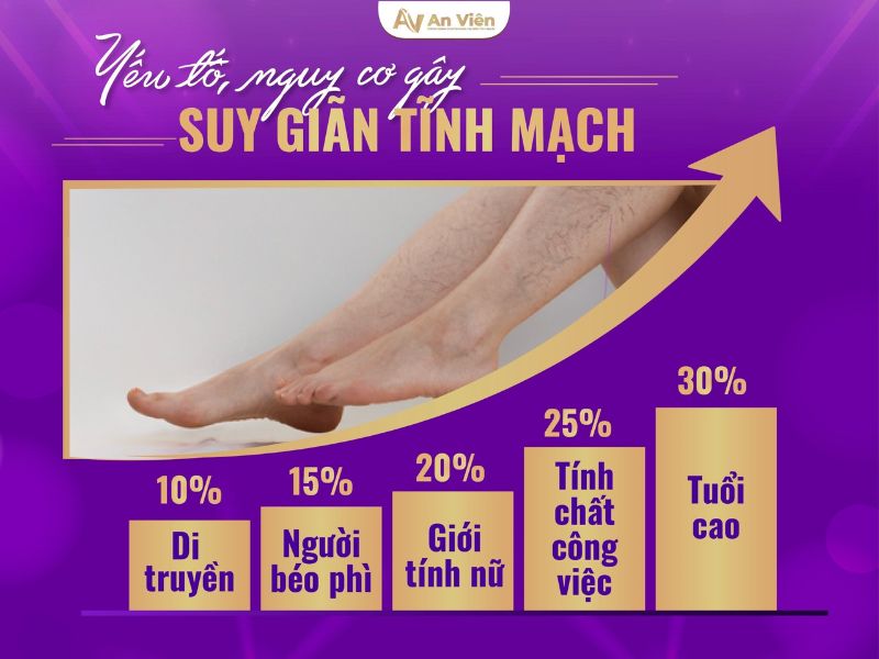 Dấu hiệu bệnh giãn tĩnh mạch chi dưới và 3 địa chỉ chữa 11 dấu hiệu bệnh giãn tĩnh mạch chi dưới