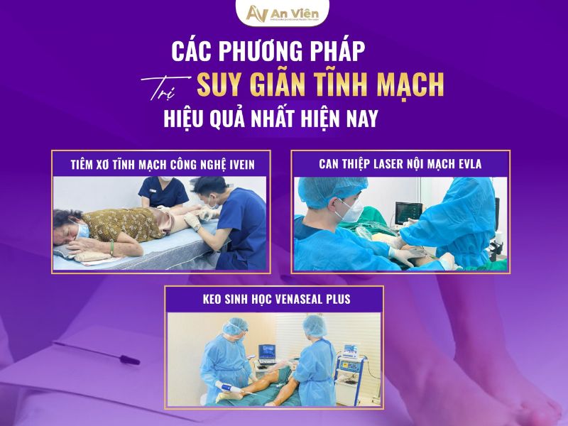 Dấu hiệu bệnh giãn tĩnh mạch chi dưới và 3 địa chỉ chữa 13 dấu hiệu bệnh giãn tĩnh mạch chi dưới