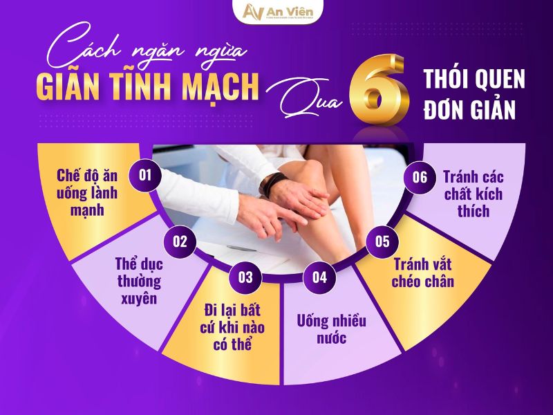 Dấu hiệu bệnh giãn tĩnh mạch chi dưới và 3 địa chỉ chữa 12 dấu hiệu bệnh giãn tĩnh mạch chi dưới