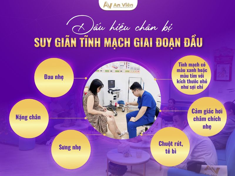 Dấu hiệu bệnh giãn tĩnh mạch chi dưới và 3 địa chỉ chữa 9 dấu hiệu bệnh giãn tĩnh mạch chi dưới