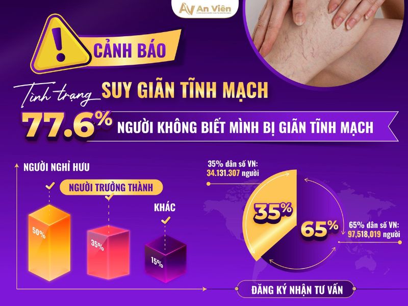 Chăm sóc giãn tĩnh mạch chân triệu chứng đúng cách 14 giãn tĩnh mạch chân triệu chứng