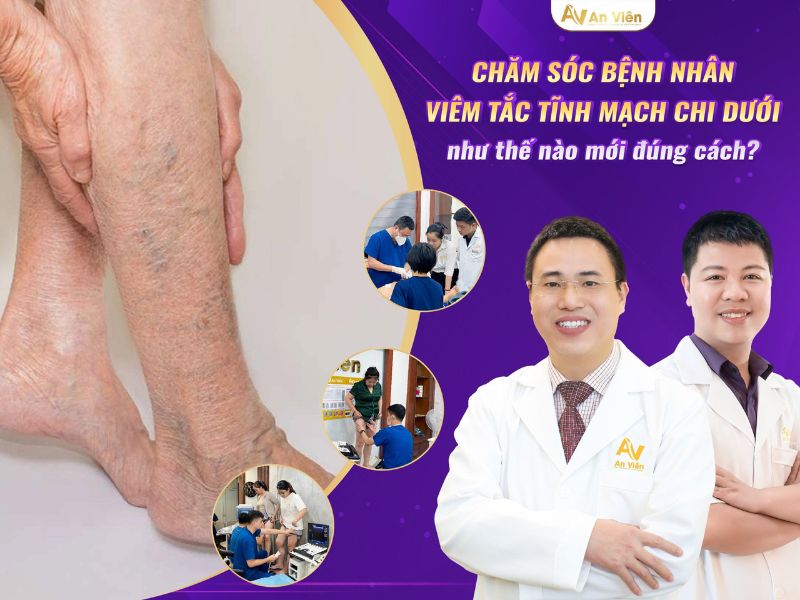 Chăm sóc giãn tĩnh mạch chân triệu chứng đúng cách 15 giãn tĩnh mạch chân triệu chứng