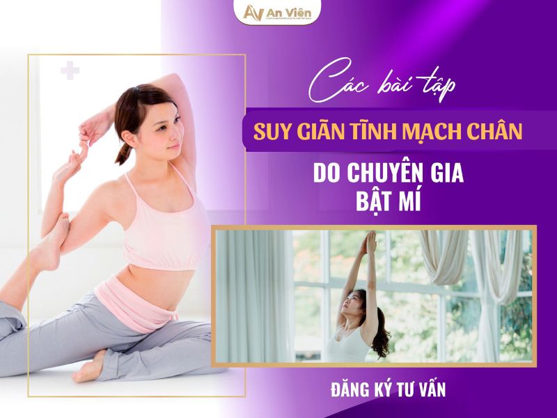 Chăm sóc giãn tĩnh mạch chân triệu chứng đúng cách 17 giãn tĩnh mạch chân triệu chứng