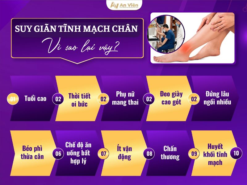 Chăm sóc giãn tĩnh mạch chân triệu chứng đúng cách 10 giãn tĩnh mạch chân triệu chứng