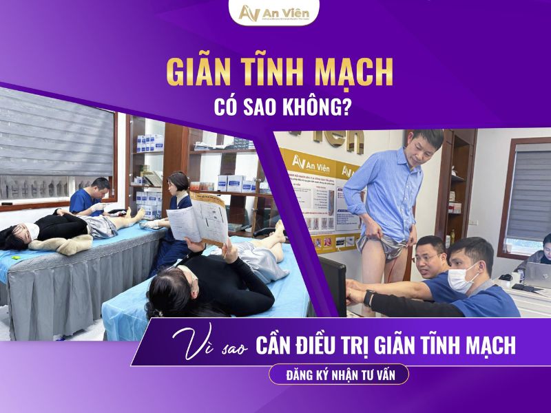 Giãn tĩnh mạch có chữa được không? Điều trị đúng cách 13 giãn tĩnh mạch có chữa được không