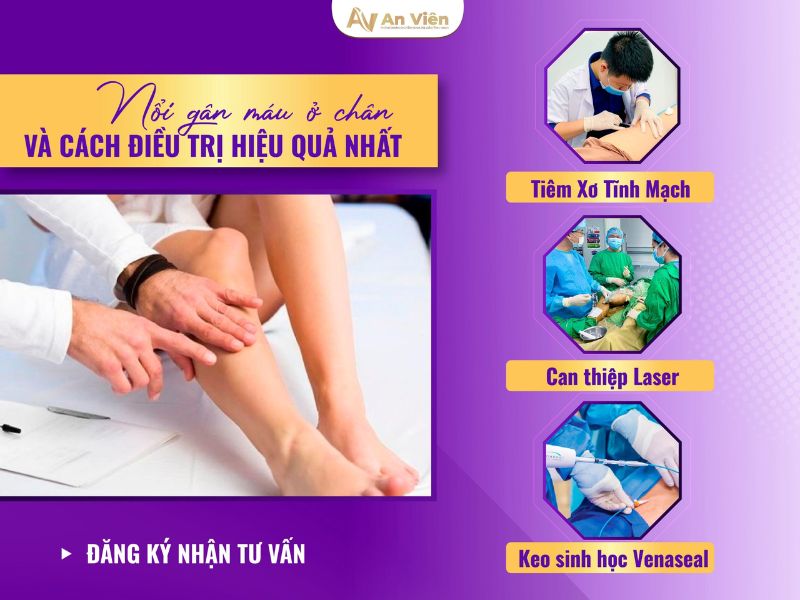 Hiện tượng nổi gân xanh ở chân cảnh báo đôi chân bị tổn thương 12 hiện tượng nổi gân xanh ở chân