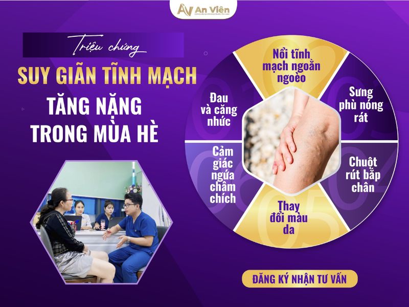 Mùa hè - Cẩn thận triệu chứng giãn tĩnh mạch ở chân tăng nặng 11 triệu chứng giãn tĩnh mạch ở chân