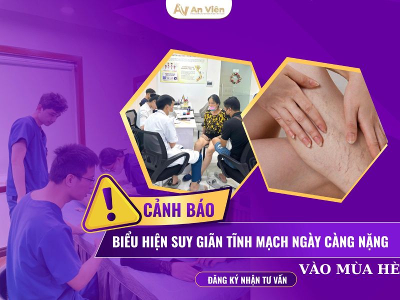 Mùa hè - Cẩn thận triệu chứng giãn tĩnh mạch ở chân tăng nặng 12 triệu chứng giãn tĩnh mạch ở chân