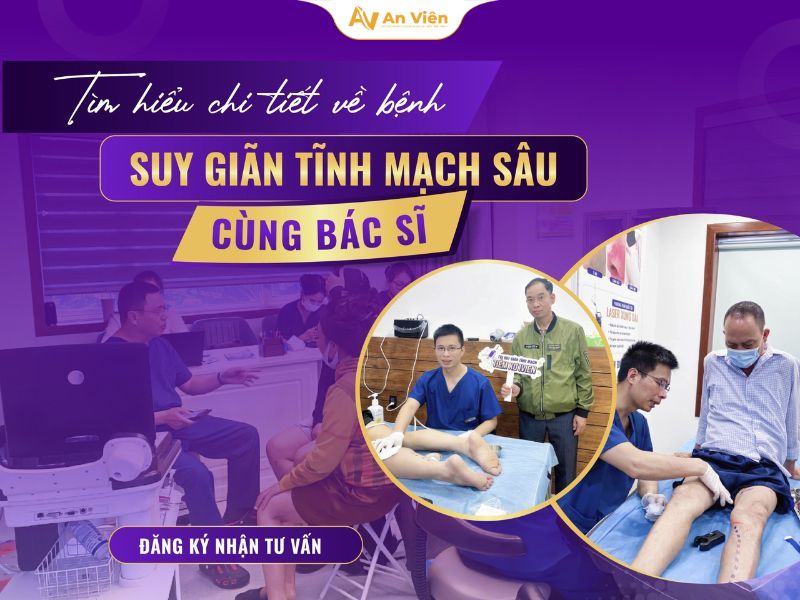 Suy van tĩnh mạch sâu chi dưới hai bên: Nguyên nhân, triệu chứng, biến chứng nguy hiểm 10 Suy van tĩnh mạch sâu chi dưới hai bên