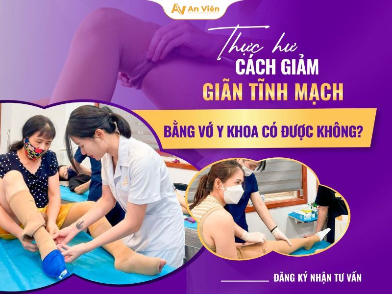 Suy van tĩnh mạch sâu chi dưới hai bên: Nguyên nhân, triệu chứng, biến chứng nguy hiểm 15 Suy van tĩnh mạch sâu chi dưới hai bên