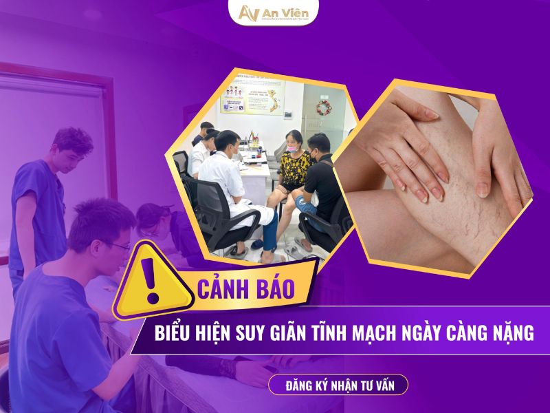 Bệnh giãn tĩnh mạch chân có nguy hiểm không? 11 bệnh giãn tĩnh mạch chân có nguy hiểm không