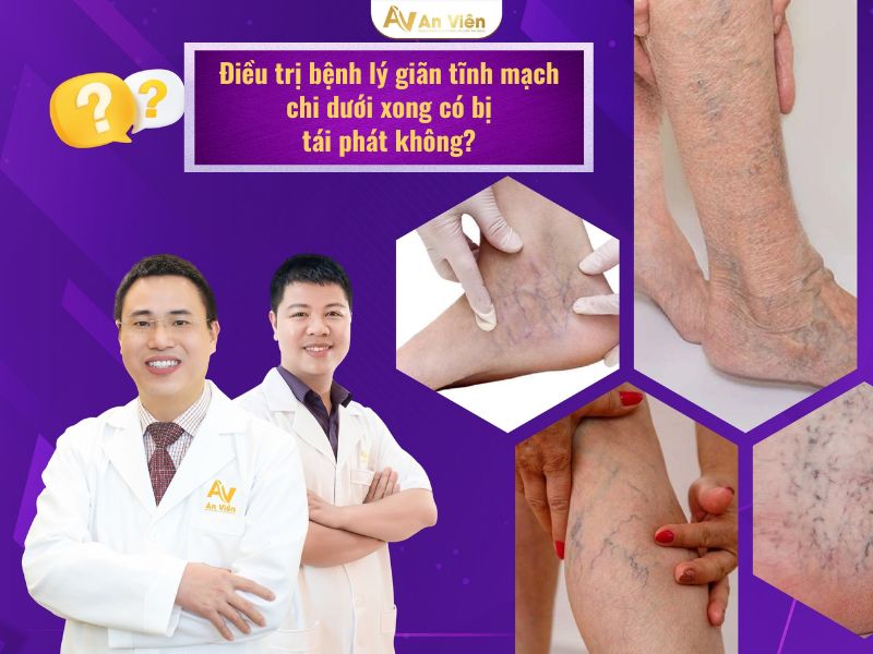 bệnh lý giãn tĩnh mạch chi dưới