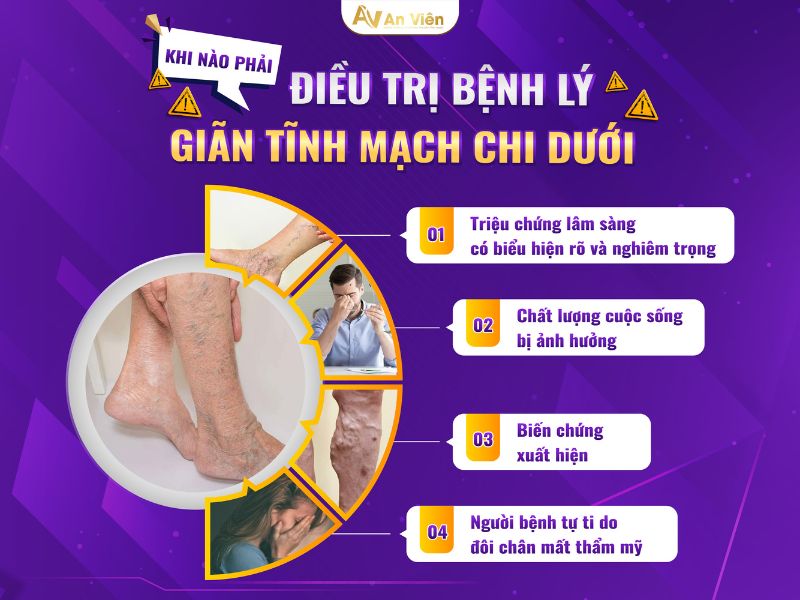 bệnh lý giãn tĩnh mạch chi dưới