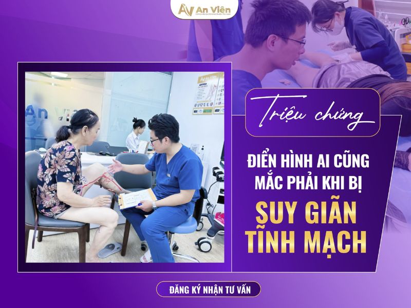 Chuột rút có phải biểu hiện bệnh giãn tĩnh mạch chân không? 8 biểu hiện bệnh giãn tĩnh mạch chân