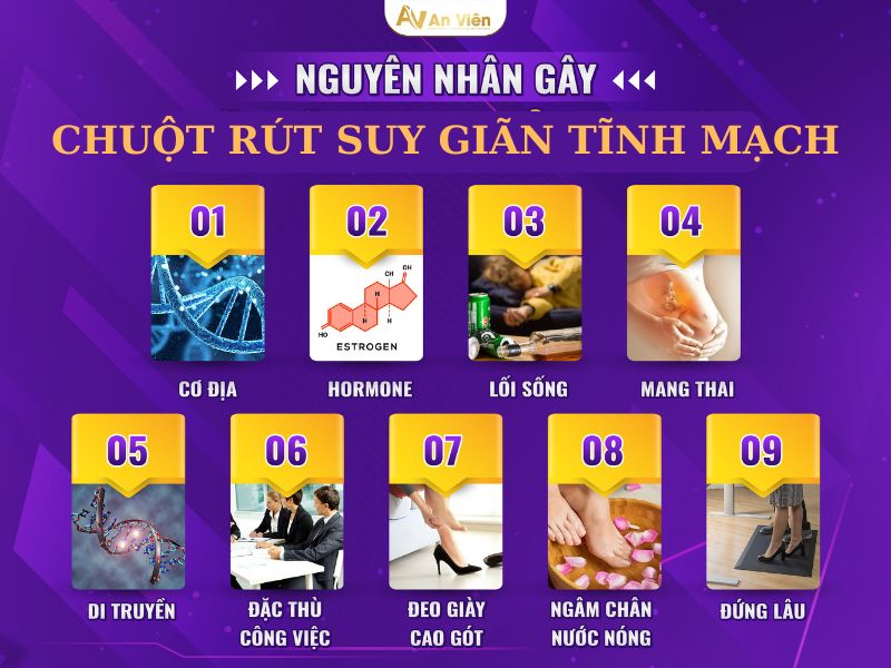 Chuột rút có phải biểu hiện bệnh giãn tĩnh mạch chân không? 9 biểu hiện bệnh giãn tĩnh mạch chân