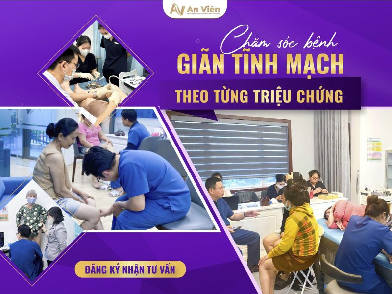 Chuột rút có phải biểu hiện bệnh giãn tĩnh mạch chân không? 11 biểu hiện bệnh giãn tĩnh mạch chân