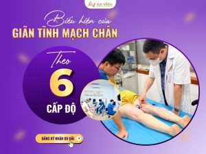 biểu hiện của giãn tĩnh mạch chân