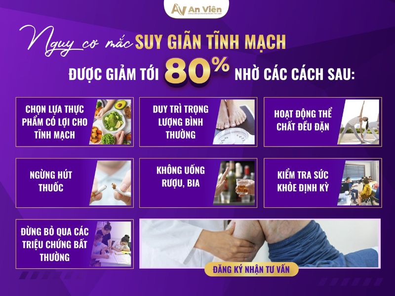 biểu hiện của giãn tĩnh mạch chân