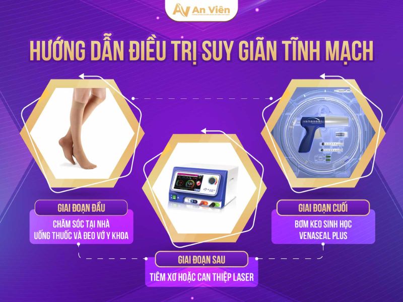 cách điều trị bệnh giãn tĩnh mạch