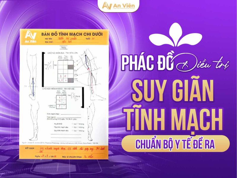 Review 3 cách trị bệnh giãn tĩnh mạch tại phòng khám An Viên 10 cách trị bệnh giãn tĩnh mạch