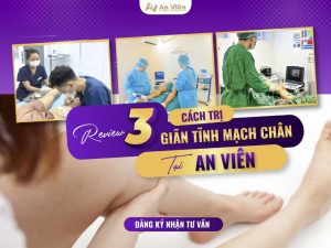 cách trị bệnh giãn tĩnh mạch