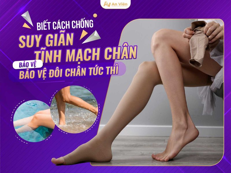 Ngưng đi bộ khi có dấu hiệu bị suy giãn tĩnh mạch chân được không? 13 dấu hiệu bị suy giãn tĩnh mạch chân