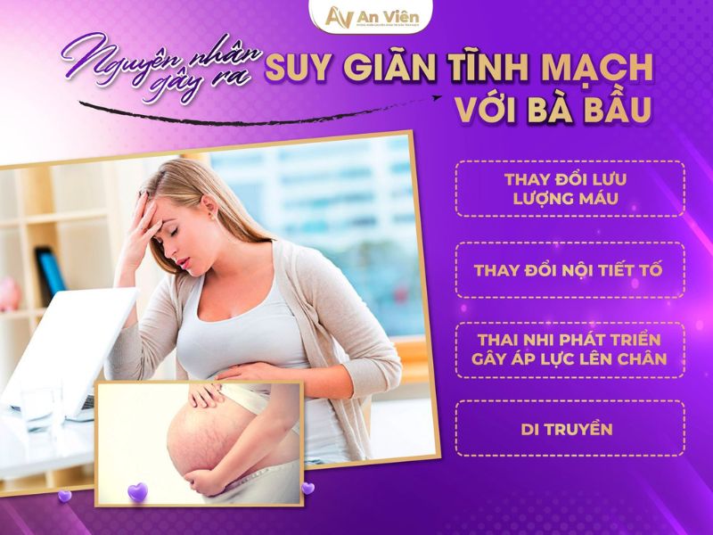 Dấu hiệu suy giãn tĩnh mạch chi dưới mẹ bầu: Phù chân 9 dấu hiệu suy giãn tĩnh mạch chi dưới