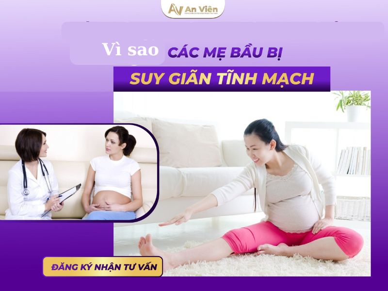 Dấu hiệu suy giãn tĩnh mạch chi dưới mẹ bầu: Phù chân 10 dấu hiệu suy giãn tĩnh mạch chi dưới